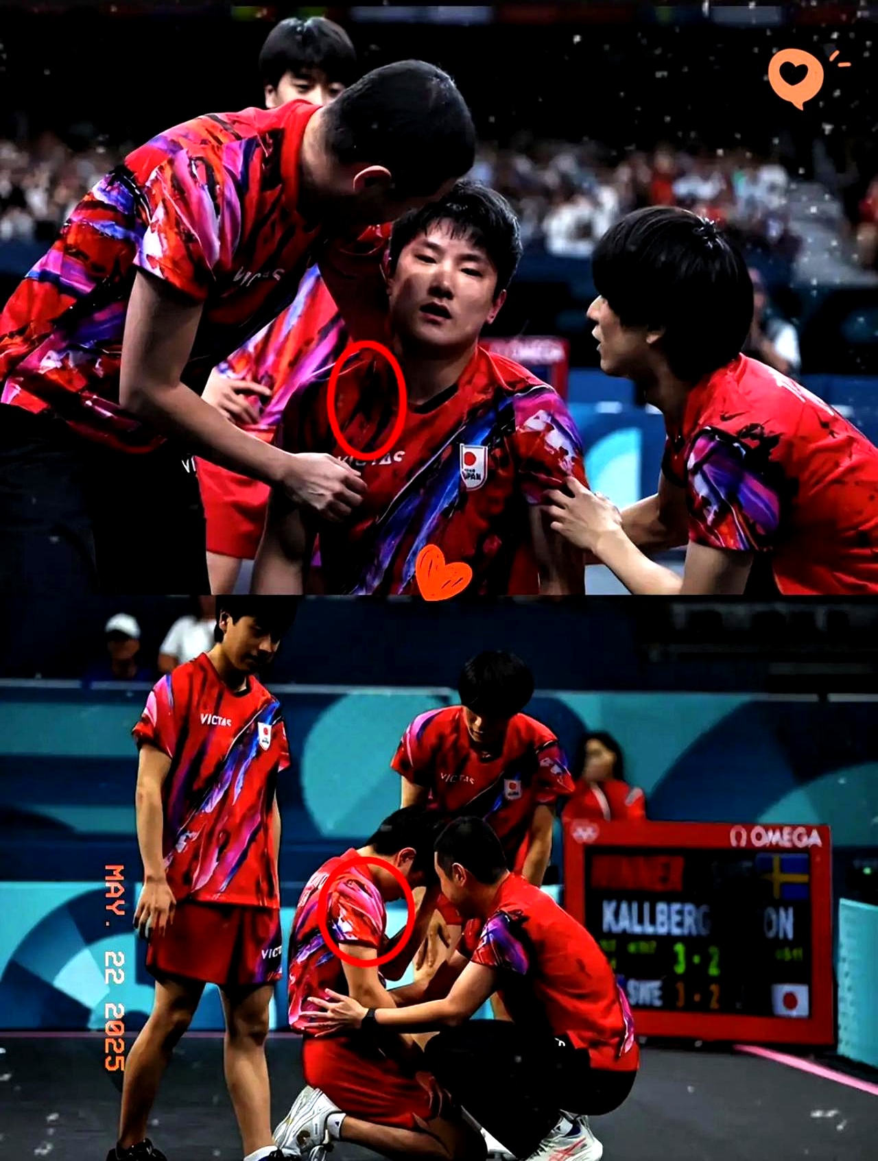 法国乒乓球队绝杀日本乒乓球队，张本智和高光表现的简单介绍